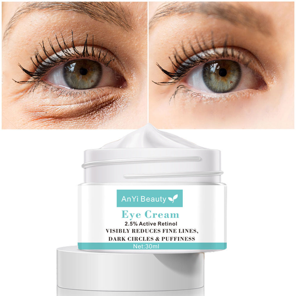 Remove Dark Circles -Eye Cream 30ml - Skin Deep Secrets