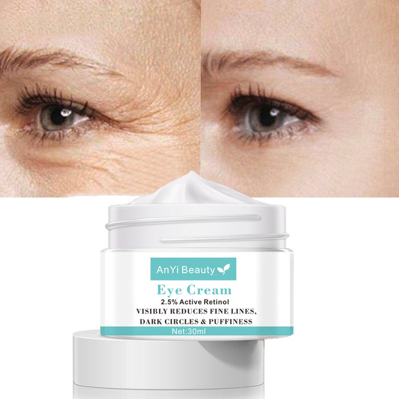 Remove Dark Circles -Eye Cream 30ml - Skin Deep Secrets