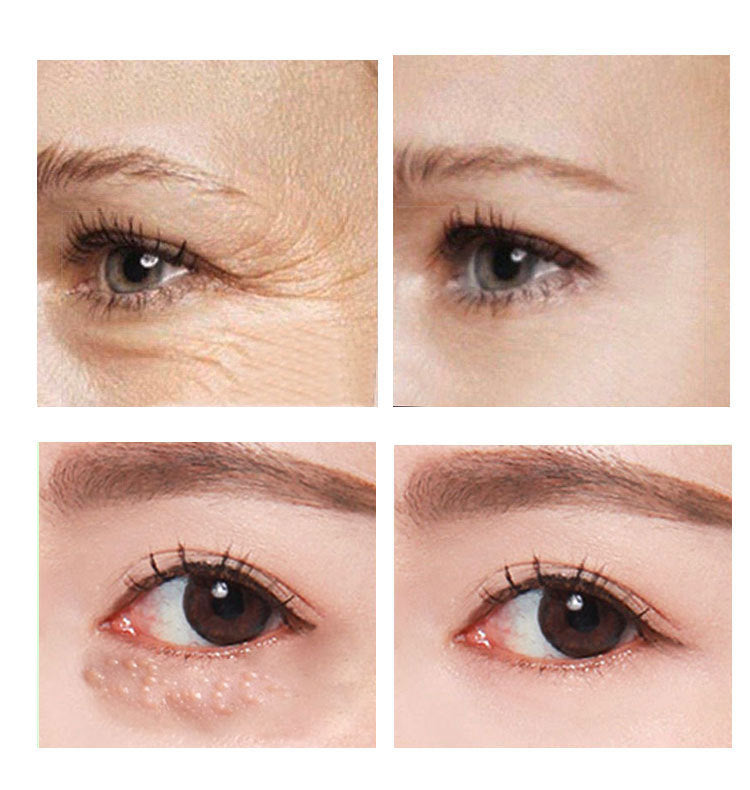 Remove Dark Circles -Eye Cream 30ml - Skin Deep Secrets