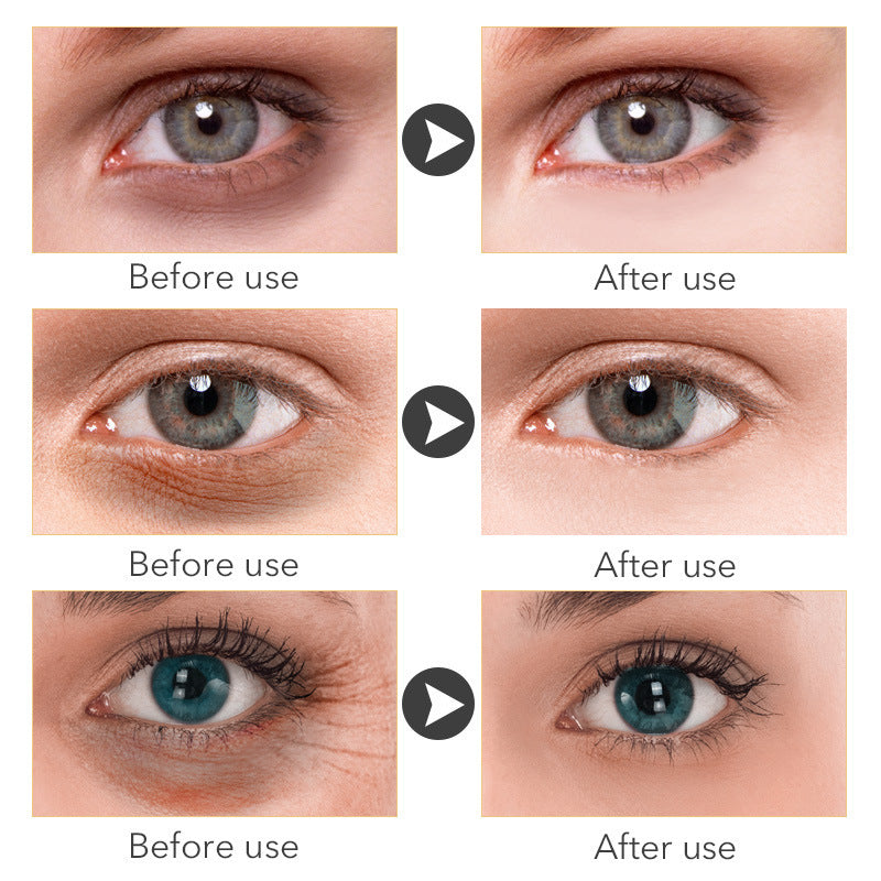 Remove Dark Circles -Eye Cream 30ml - Skin Deep Secrets