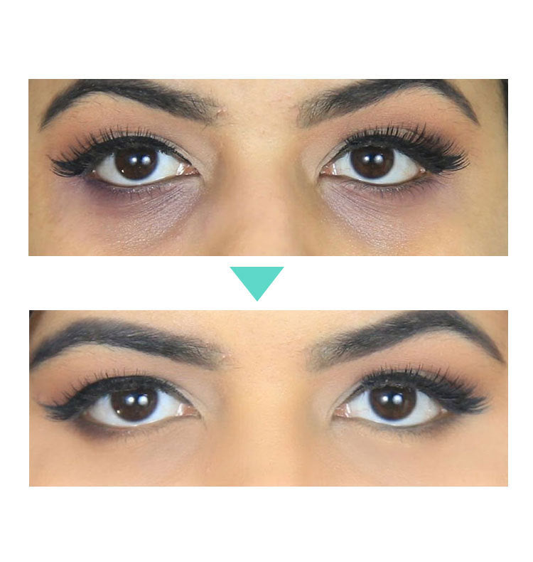 Remove Dark Circles -Eye Cream 30ml - Skin Deep Secrets 