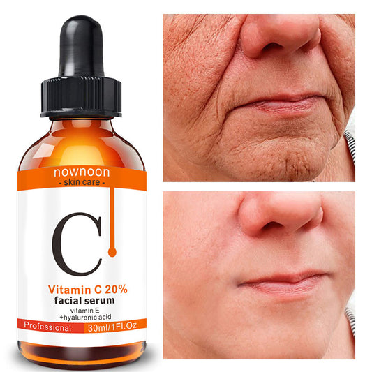 Turn Back Time with Our Vitamin C Facial Serum 30ml: Unlock Radiant, Youthful Skin! - Skin Deep Secrets 